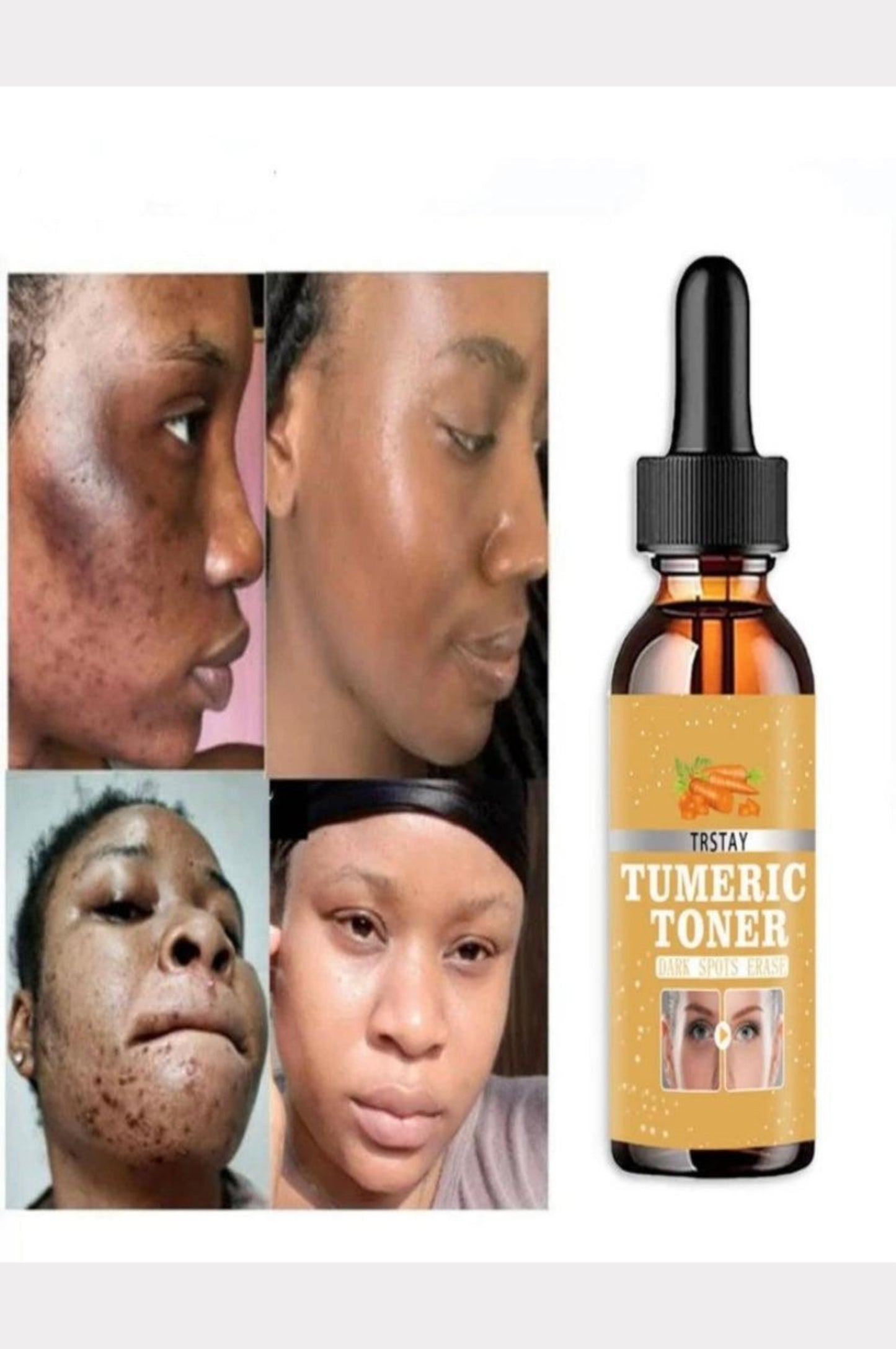 Turmeric Lemon
Skin Glow Face Serum